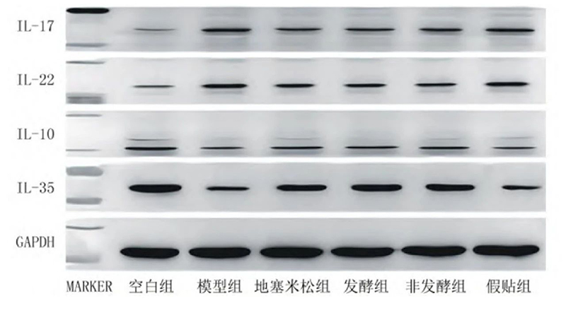 空白組和支氣管哮喘各組大鼠肺組織中IL－17、IL－22、IL－10、IL－35蛋白表達(dá)電泳圖